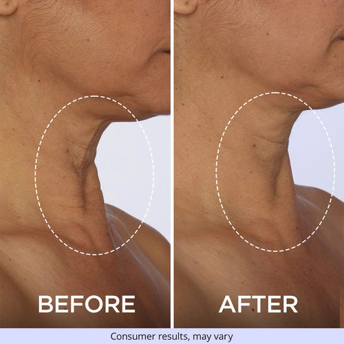 Neck Firming Mask
