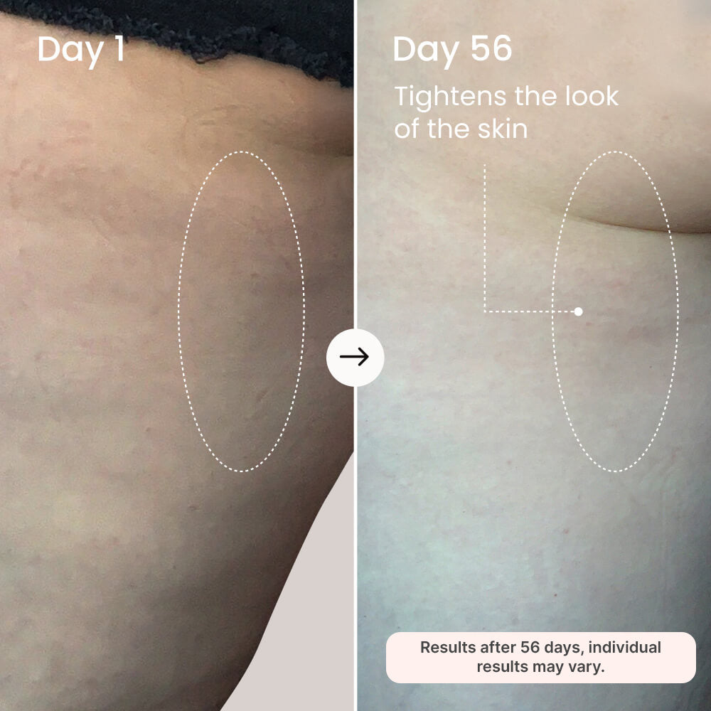 Micro Infusion Serum